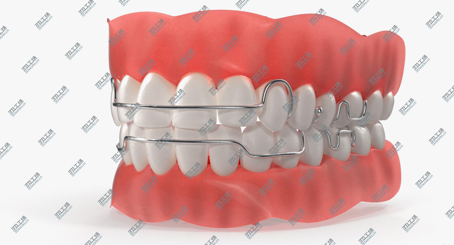 images/goods_img/2021040165/Typodont Tooth Orthodontic Retainer model/3.jpg